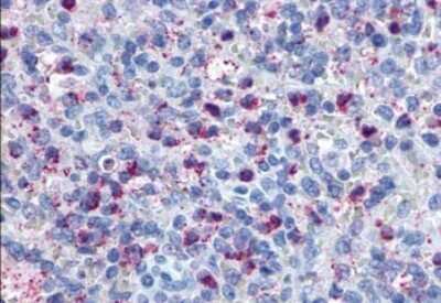 Immunohistochemistry-Paraffin: GPR34 Antibody [NLS1259] - Anti-GPR34 antibody IHC of human spleen. Immunohistochemistry of formalin-fixed, paraffin-embedded tissue after heat-induced antigen retrieval.