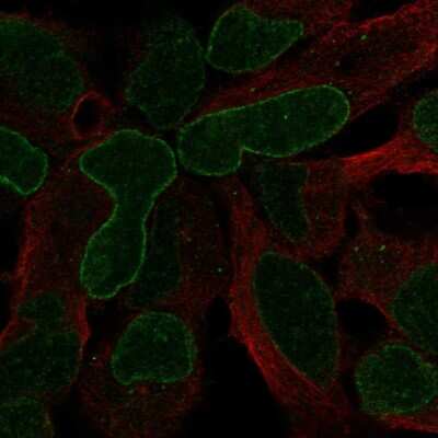 Immunocytochemistry/Immunofluorescence: GPR37 Antibody [NBP2-55267] - Staining of human cell line AF22 shows localization to nuclear membrane. Antibody staining is shown in green.