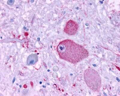 Immunohistochemistry-Paraffin: GPR37 Antibody [NLS129] - Analysis of anti-GPR37 antibody with human brain, neurons and glia at 1 ug/ml.
