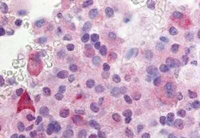 Immunohistochemistry-Paraffin: GPR37L1 Antibody - BSA Free [NBP1-02382] - Staining of human anterior pituitary. Immunohistochemistry of formalin-fixed, paraffin-embedded tissue after heat-induced antigen retrieval. Antibody concentration 10 ug/ml.