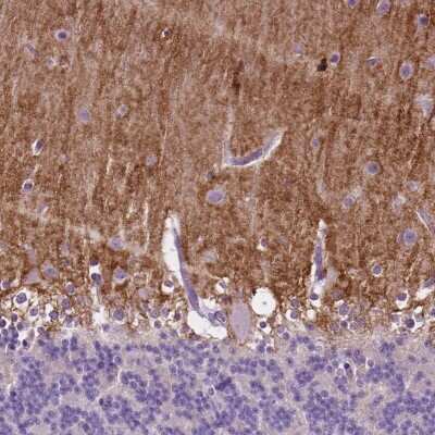 Immunohistochemistry: GPR37L1 Antibody [NBP2-49419] - Staining of human cerebellum shows moderate positivity in the molecular layer.
