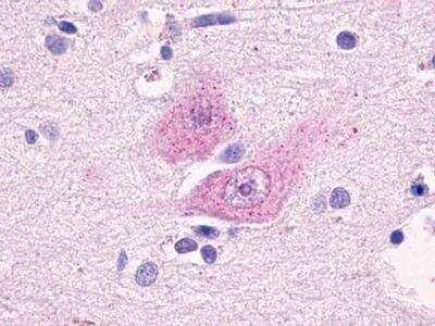 Immunohistochemistry-Paraffin: GPR37L1 Antibody [NLS405] - Analysis of anti-GPR37L1 antibody with human brain, cortex.