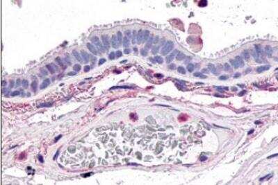 Immunohistochemistry-Paraffin: GPR4 Antibody [NLS143] - Human lung, respiratory epithelium. Immunohistochemistry of formalin-fixed, paraffin-embedded tissue after heat-induced antigen retrieval.