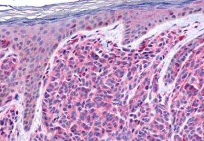 Immunohistochemistry-Paraffin GPR4 Antibody - BSA Free