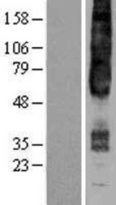Western Blot: GPR4 Overexpression Lysate (Adult Normal) [NBP2-04284] Left-Empty vector transfected control cell lysate (HEK293 cell lysate); Right -Over-expression Lysate for GPR4.