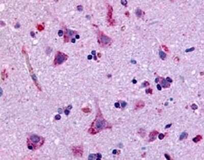 Immunohistochemistry-Paraffin: GPR45 Antibody [NLS1227] - Analysis of anti-GPR45 antibody with human brain, neurons and glia.