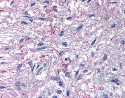 Immunohistochemistry-Paraffin: GPR50 Antibody [NLS6621] - Analysis of anti-GPR50 antibody with human pituitary.