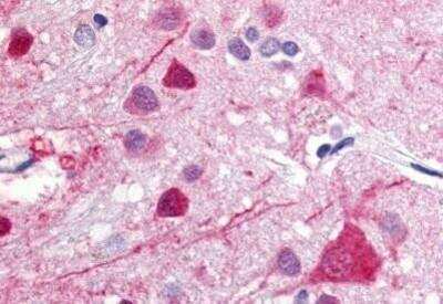 Immunohistochemistry-Paraffin: GPR52 Antibody [NB100-58996] - Analysis of anti-GPR52 antibody with human brain at concentration 2.5 ug/ml.