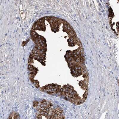 Immunohistochemistry-Paraffin GPR52 Antibody - BSA Free