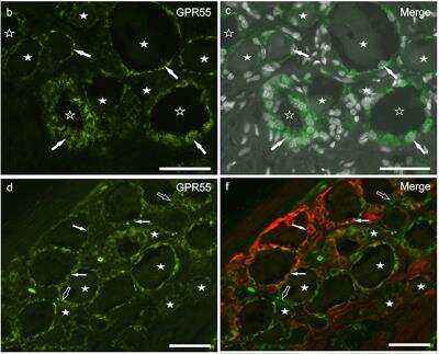 Immunohistochemistry: GPR55 Antibody [NB110-55498] - Photomicrographs of cryosections of canine cervical (C8) dorsal root ganglion showing GPR55 (b-f) immunolabeling. (a-c) Arrows indicate the Neurotrace-labeled nuclei of satellite glial cells which showed bright GPR55 immunolabelling (c). White stars indicate unlabeled sensory neurons; open stars indicate empty spaces in which sensory neurons were no more evident. (d-f) White arrows indicate satellite glial cells which co-expressed bright GPR55- (d) and glial fibrillary acidic protein (GFAP) immunoreactivity. Stars indicate sensory neurons of different dimension, which expressed faint-to-moderate GPR55 immunoreactivity. Open arrow indicate autofluorescent pigment. Bar: 50 um. Image collected and cropped by CiteAb from the following publication (//www.frontiersin.org/article/10.3389/fvets.2019.00313/full) licensed under a CC-BY license.