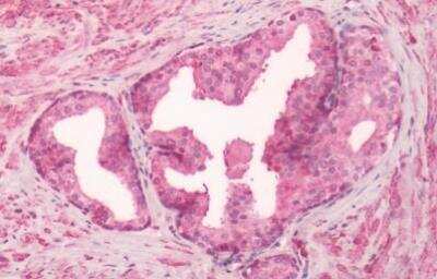 Immunohistochemistry-Paraffin: GPR55 Antibody [NLS6817] - Analysis of anti-GPR55 antibody with human prostate.