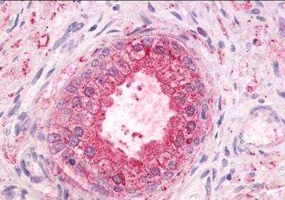 Immunohistochemistry-Paraffin: GPR55 Antibody [NLS6817] - Analysis of anti-GPR55 antibody with human prostate, benign prostatic hyperplasia.