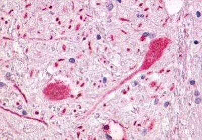 Immunohistochemistry-Paraffin: GPR55 Antibody [NLS6817] - Human brain, putamen