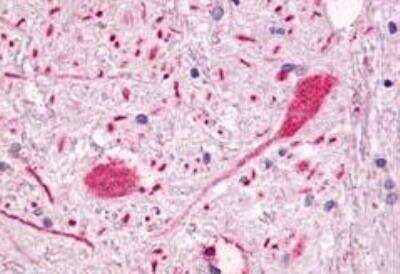 Immunohistochemistry-Paraffin: GPR55 Antibody [NLS6817] - Brain, Globus Pallidus