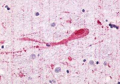 Immunohistochemistry-Paraffin: GPR55 Antibody [NLS6817] - Brain, Globus Pallidus