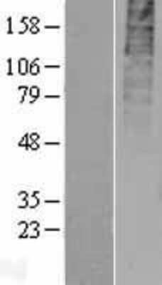 Western Blot: GPR55 Overexpression Lysate (Adult Normal) [NBL1-11284] Left-Empty vector transfected control cell lysate (HEK293 cell lysate); Right -Over-expression Lysate for GPR55.