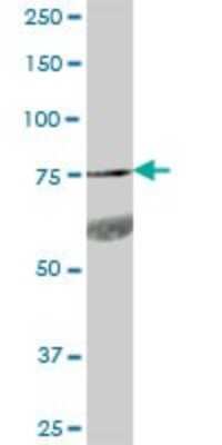 Western Blot: GPR56 Antibody [H00009289-B01P] - Analysis of GPR56 expression in human stomach.