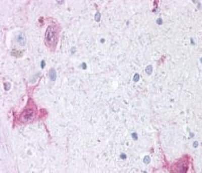 Immunohistochemistry GPR6 Antibody - BSA Free