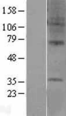 Western Blot: GPR6 Overexpression Lysate (Adult Normal) [NBL1-11286] Left-Empty vector transfected control cell lysate (HEK293 cell lysate); Right -Over-expression Lysate for GPR6.