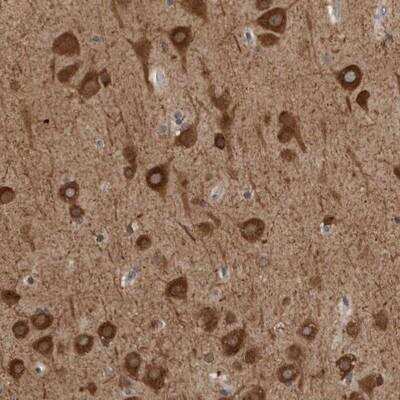 Immunohistochemistry: GPR61 Antibody [NBP1-88716] - Staining of human cerebral cortex shows strong cytoplasmic positivity in neuronal cells.