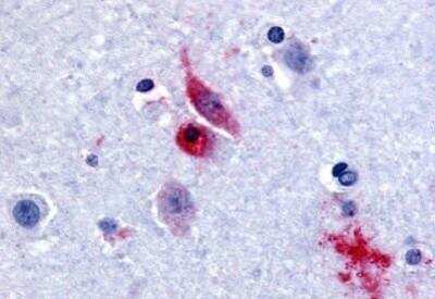Immunohistochemistry-Paraffin: GPR61 Antibody [NB100-59012] - Analysis of anti-GPR61 antibody with human brain, caudate at concentration 30 ug/ml.