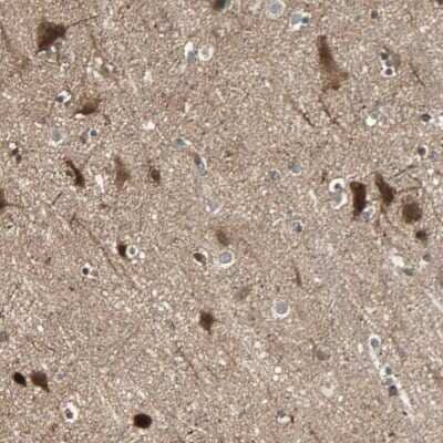 Immunohistochemistry-Paraffin: GPR61 Antibody [NBP1-88717] - Staining of human cerebral cortex shows strong cytoplasmic positivity in neuronal cells and glial cells.