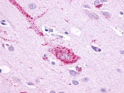 Immunohistochemistry-Paraffin: GPR61 Antibody [NLS1685] - Analysis of anti-GPR61 antibody with human brain, neurons and glia at 22 ug/ml