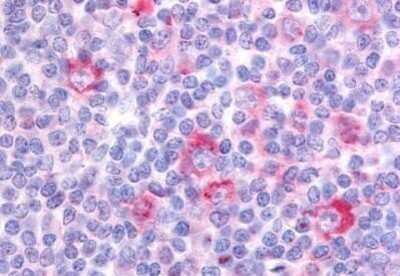 Immunohistochemistry-Paraffin: GPR62 Antibody [NB100-58985] - Analysis of anti-GPR62 antibody with human tonsil at concentration 20 ug/ml.
