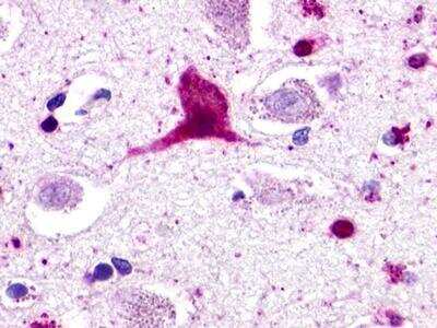 Immunohistochemistry-Paraffin: GPR62 Antibody [NLS510] - Analysis of anti-GPR62 antibody with human brain, neurons and glia.