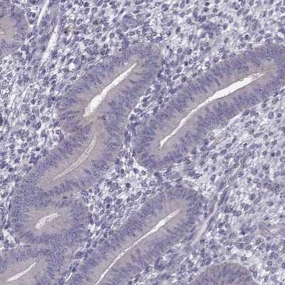 Immunohistochemistry-Paraffin: GPR64 Antibody [NBP1-84906] - Staining of human endometrium shows no positivity in glandular cells as expected.