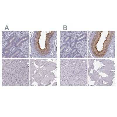 <b>Independent Antibodies Validation and Orthogonal Strategies Validation.</b>Immunohistochemistry-Paraffin: GPR64 Antibody [NBP1-84906] - Staining of human endometrium, epididymis, liver and skeletal muscle using Anti-ADGRG2 antibody NBP1-84906 (A) shows similar protein distribution across tissues to independent antibody NBP2-55504 (B).