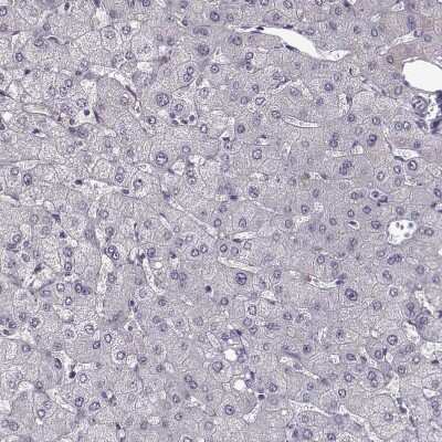 Immunohistochemistry-Paraffin: GPR64 Antibody [NBP1-84906] - Staining of human liver shows no positivity in hepatocytes as expected.