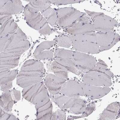 Immunohistochemistry-Paraffin: GPR64 Antibody [NBP1-84906] - Staining of human skeletal muscle shows no positivity in myocytes as expected.