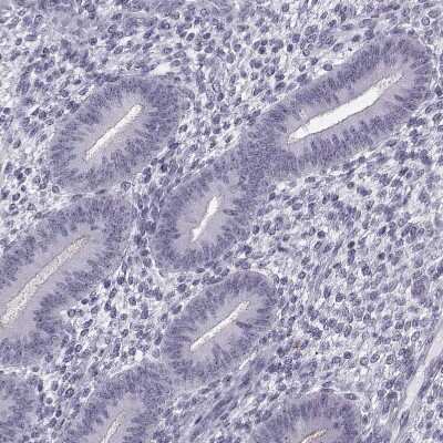 Immunohistochemistry-Paraffin: GPR64 Antibody [NBP2-55504] - Staining of human endometrium shows no positivity in glandular cells as expected.