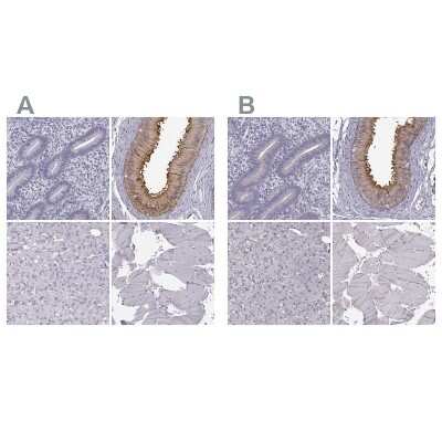 <b>Independent Antibodies Validation. </b>Immunohistochemistry-Paraffin: GPR64 Antibody [NBP2-55504] - Staining of human endometrium, epididymis, liver and skeletal muscle using Anti-ADGRG2 antibody NBP2-55504 (A) shows similar protein distribution across tissues to independent antibody NBP1-84906 (B).