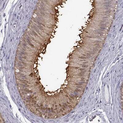 Immunohistochemistry-Paraffin: GPR64 Antibody [NBP2-55504] - Staining of human epididymis shows strong positivity in microvilli in glandular cells.