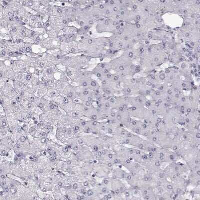 Immunohistochemistry-Paraffin: GPR64 Antibody [NBP2-55504] - Staining of human liver shows no positivity in hepatocytes as expected.