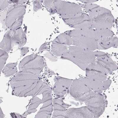 Immunohistochemistry-Paraffin: GPR64 Antibody [NBP2-55504] - Staining of human skeletal muscle shows no positivity in myocytes as expected.