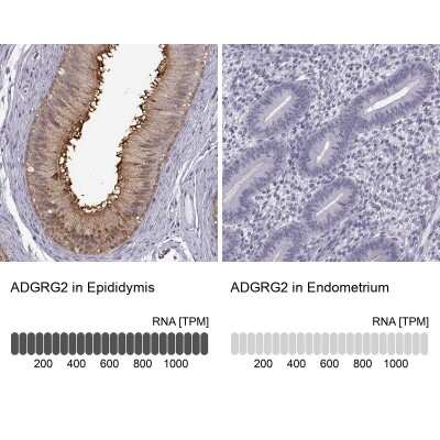 <b>Orthogonal Strategies Validation. </b>Immunohistochemistry-Paraffin: GPR64 Antibody [NBP2-55504] - Staining in human epididymis and endometrium tissues using NBP2-55504 antibody. Corresponding ADGRG2 RNA-seq data are presented for the same tissues.