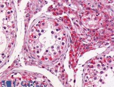 Immunohistochemistry-Paraffin: GPR64 Antibody [NLS1262] - Human testis. Immunohistochemistry of formalin-fixed, paraffin-embedded tissue after heat-induced antigen retrieval.