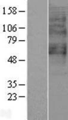 Western Blot: GPR65 Overexpression Lysate (Adult Normal) [NBP2-04251] Left-Empty vector transfected control cell lysate (HEK293 cell lysate); Right -Over-expression Lysate for GPR65.