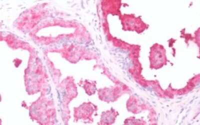 Immunohistochemistry-Paraffin: OGR1 Antibody [NLS1194] -  Human Prostate: Formalin-Fixed, Paraffin-Embedded (FFPE)