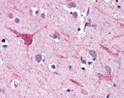 Immunohistochemistry-Paraffin: GPR74/NPFFR2 Antibody [NLS3302] - Analysis of anti-NPFF2 / NPFFR2 antibody with brain, neurons and glia.