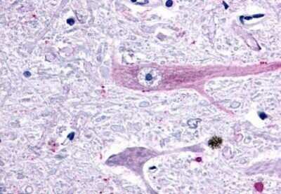 Immunohistochemistry-Paraffin: GPR75 Antibody [NBP1-02389] - Staining of human brain, medulla. Immunohistochemistry of formalin-fixed, paraffin-embedded tissue after heat-induced antigen retrieval. Antibody concentration 20 ug/ml.