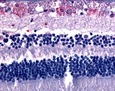 Immunohistochemistry-Paraffin: GPR75 Antibody [NLS1594] - Analysis of anti-GPR75 antibody with human eye, retina.