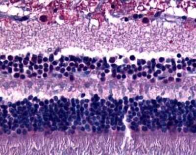 Immunohistochemistry-Paraffin: GPR75 Antibody [NLS3252] - Analysis of anti-GPR75 antibody with retina.