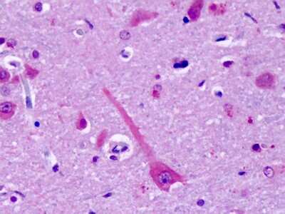 Immunohistochemistry-Paraffin: GPR75 Antibody [NLS3252] - Analysis of anti-GPR75 antibody with human brain, cortex, neurons at dilution 4-7 ug/ml.