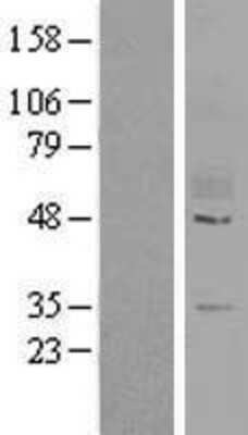 Western Blot: GPR78 Overexpression Lysate (Adult Normal) [NBL1-11293] Left-Empty vector transfected control cell lysate (HEK293 cell lysate); Right -Over-expression Lysate for GPR78.