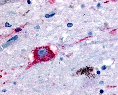 Immunohistochemistry-Paraffin: GPR8 Antibody [NLS175] - IHC staining of human brain, neurons and glia using this antibody at 2.5 ug/ml.
