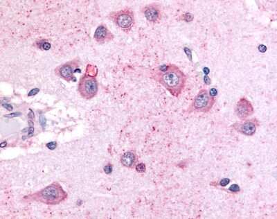 Immunohistochemistry-Paraffin: GPR8 Antibody [NLS6636] - Analysis of anti-NPBWR2 / GPR8 antibody with brain, neurons and glia at 12 ug/ml.